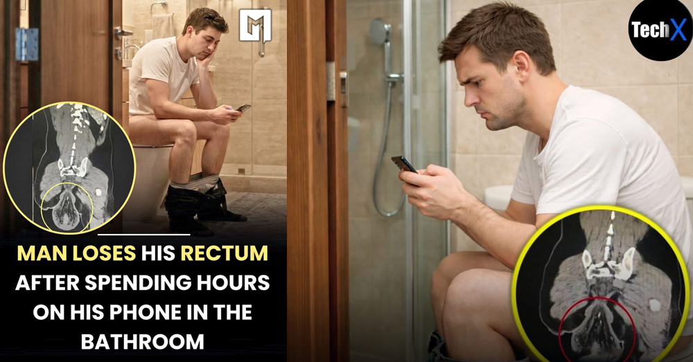 គ្រោះថ្នាក់ដែលស្មានមិនដល់៖ បុរសម្នាក់ធ្លាក់ «សរីរាង្គខាងក្នុង» ចេញមកក្រៅ ក្រោយអង្គុយចុចទូរសព្ទក្នុងបង្គន់យូរពេក