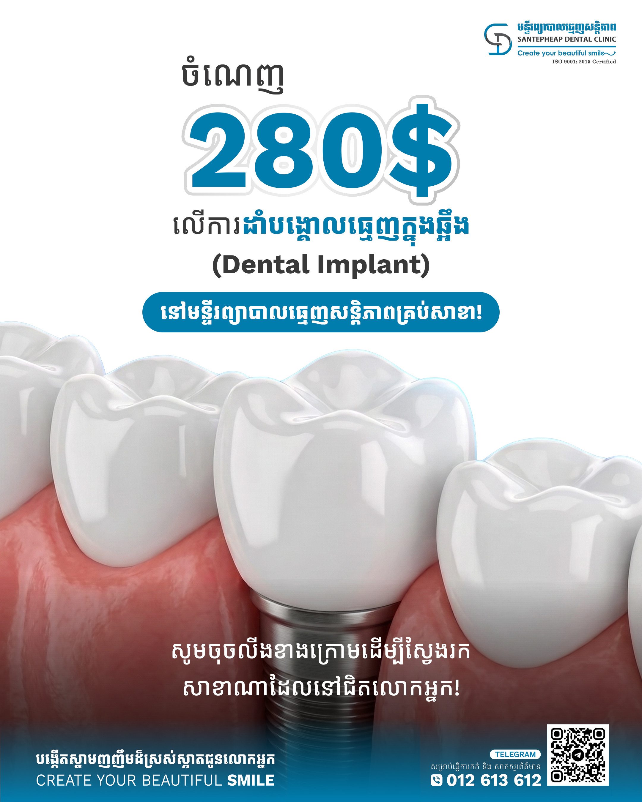 ⁨ចំណេញ ២៨០ដុល្លារ លើការដាំបង្គោលធ្មេញក្នុងឆ្អឹង ពីមន្ទីរព្យាបាលធ្មេញសន្តិភាព!